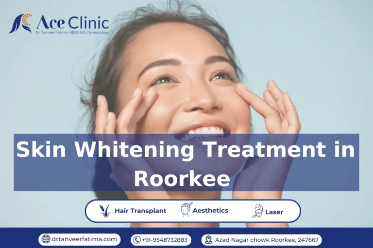 Smiling woman touching her face, promoting skin whitening treatment in Roorkee at ACE Clinic by Dr. Tanveer Fatima.