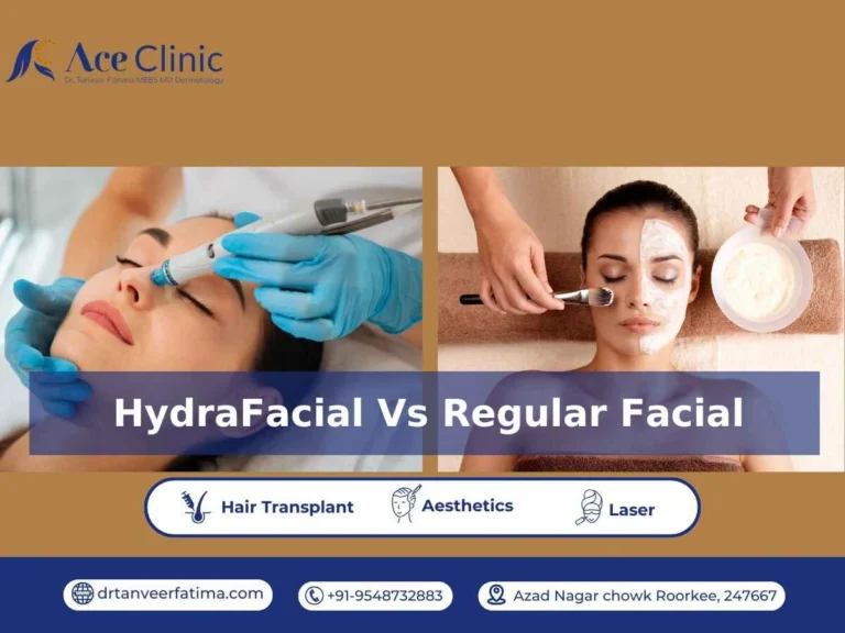 A dermatologist performing a HydraFacial vs regular facial at ACE Clinic Roorkee.
