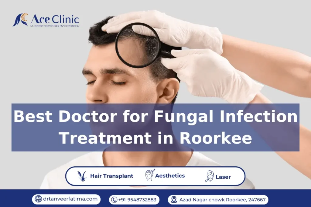 Best doctor for fungal infection in Roorkee – Dr. Tanveer Fatima at ACE Clinic Roorkee providing expert treatment